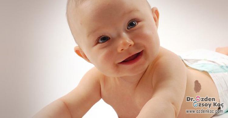 Çocuklarda & Bebeklerde Doğum Lekesi - Tedavileri